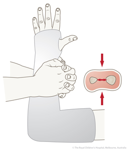 ED_Section 9_INTEROSSEOUS MOULDING 2.JPG